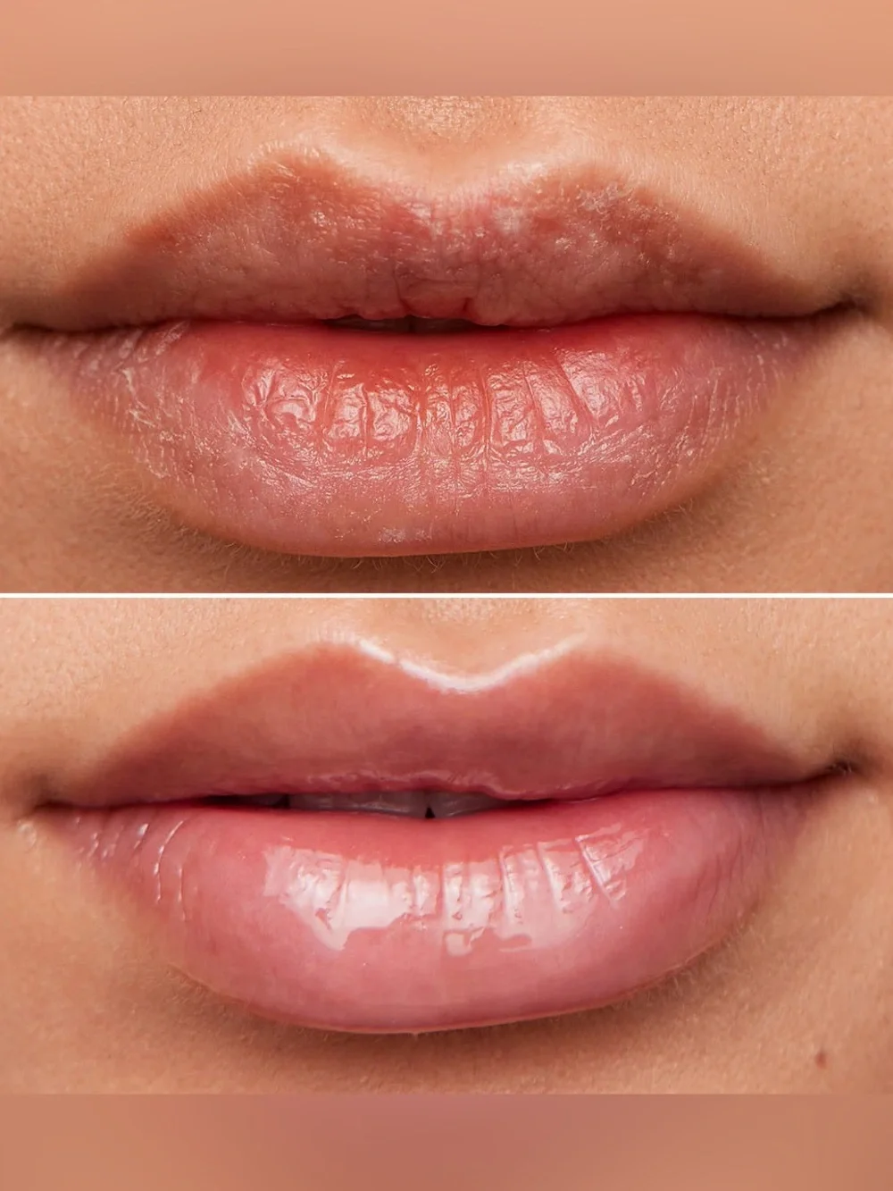 Wonderskin LIP Rehab Serum Oil - Clear NIB